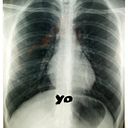 Diego Morales-Portillo