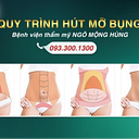 Hút mỡ bụng nmh