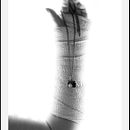 Diario de una lisiada . % Alexandra González tarafından hazırlanan Güzel sanatlar, Ve Fotoğrafçılık projesi - 02.10.2016