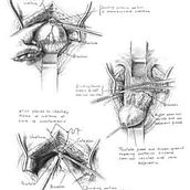 Ilustración médica. Un projet de Design , Illustration traditionnelle, 3D , et Publicité de Ana Freimar - 09.11.2011
