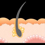FLash animation. Laser operation for hair removal.. Un progetto di Animazione e Design di María Terrazas Alber - 16.02.2018