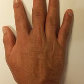 Mi Proyecto del curso: memoria de mi mascota CICATRICES . Un proyecto de Stor y telling de Juan Iparraguirre - 12.02.2021