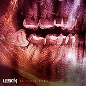 El Viejo Daño - LESIÓN. Music, Film, Video, TV, and Video project by Alfredo Garcia Burga - 10.13.2020