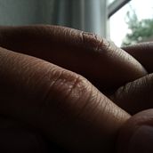 Inhabited skin. Writing, Creativit, Stor, telling, and Narrative project by ramosmonn7 - 10.10.2021