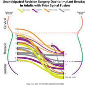 Tracking spinal revision surgery. Design gráfico, Design de informação e Infografia projeto de emmacc21 - 04.12.2023