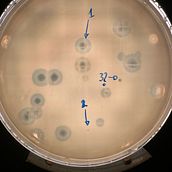 Contador de UFP en bacteriófagos.. Un projet de Développement d'applications de Jesus Hernandez - 21.03.2025