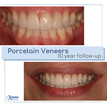 Kriebel Dental CR. Br, ing & Identit project by Marcela Kriebel - 09.06.2020
