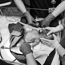 Mon projet du cours : Photojournalisme et photographie sociale - "La naissance d'un prématuré". Photograph, Photograph, Post-production, Outdoor Photograph, Documentar, and Photograph project by Luis Modesto - 06.14.2021