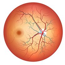 Modelo de red neuronal convolucional para la detección de retinopatía diabética en imágenes médicas.👩🏻‍⚕️👨🏻‍⚕️. Programming, Artificial Intelligence, and Web Development project by Richard Rosario Sánchez - 11.19.2023