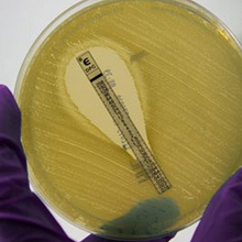 Candida albicans Resistance Tracker