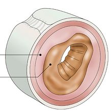 Infografías médicas. Infographics project by Xavi Isern - 04.06.2016