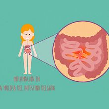Sin gluten. Video Explicativo animado.. Animation, Marketing, and Motion Graphics project by Marco Barneto - 10.11.2016