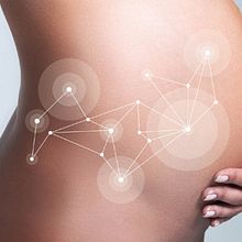 ANTI STRECH MARKS DERMOCOSMETICS. Un progetto di Direzione artistica, Graphic design e Pubblicità di Adalaisa Soy - 22.02.2015