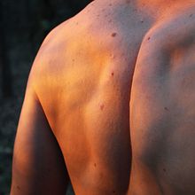 SKIN. Een project van Fotografie van LUcY - 30.04.2017