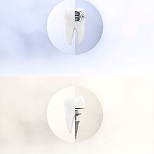 Tratamientos de odontología ( IDENTAL ). Un projet de 3D, Beaux Arts, Br, ing et identité, Design , Conception de produits, Conception éditoriale, Design graphique, Webdesign, Illustration traditionnelle, Publicité , et Retouche photographique de Irene Gómez - 07.09.2017