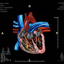 My project in Surrealistic Photomontage with Photoshop  course -"Biomechanical heart and Heart Attack Scan !!". Un progetto di Animazione 2D, Illustrazione digitale e Fotografia digitale di Mahendra Singh Chouhan - 30.06.2020