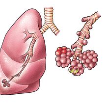 Without oxygen, for El Universal's infographic. Projekt z dziedziny Ilustracja c i frowa użytkownika Ani Cortés - 27.08.2020
