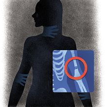 Hospitals do not protect battered women well. Projekt z dziedziny Ilustracja c i frowa użytkownika Ani Cortés - 27.08.2020