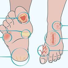 Medical Illustrations. Communication, Digital Illustration, and Traditional illustration project by Claudia Dominguez - 03.16.2021