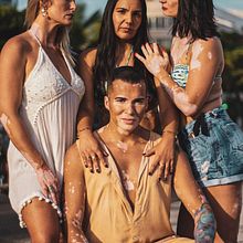 Extraordinárias Cores Vitiligo. Projekt z dziedziny Fotografia użytkownika msabbaga - 10.06.2021