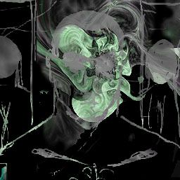 SPLEEN 5