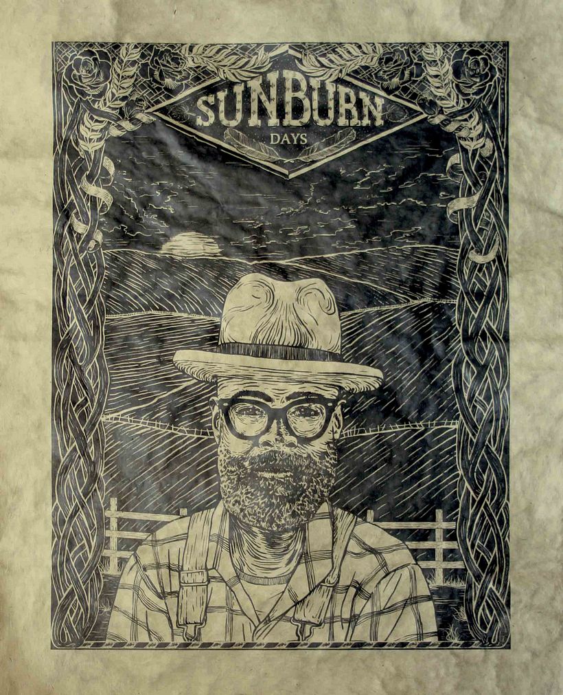 SUNBURN DAYS 3
