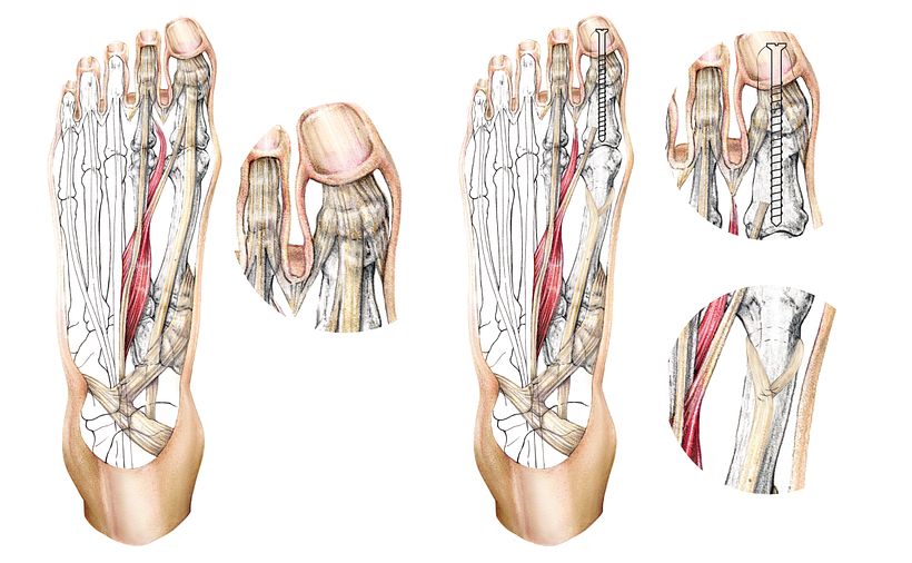 Individuus_Illustration 4