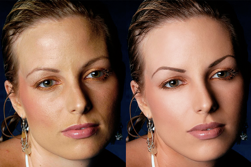 before&after 4