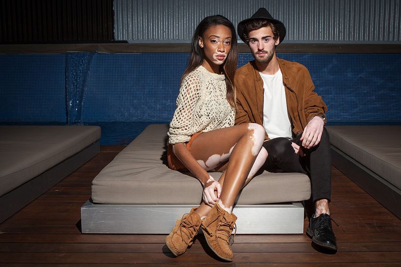 Winnie Harlow en Axel Hotel (BCN) 4