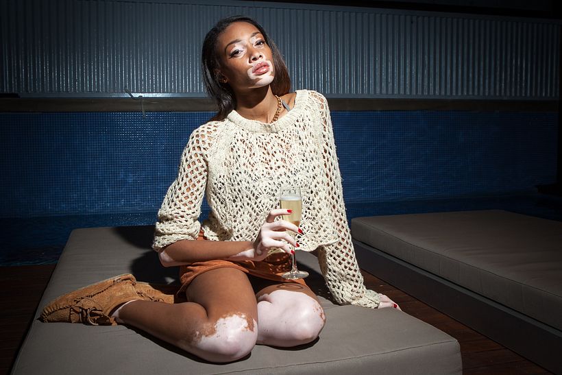 Winnie Harlow en Axel Hotel (BCN) 8