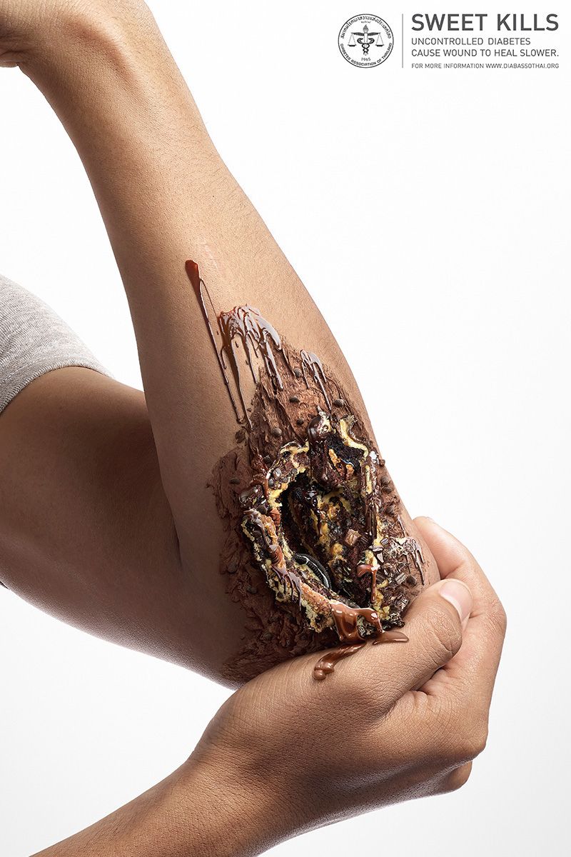 Sweet Kills: publicidad contra la diabetes 1