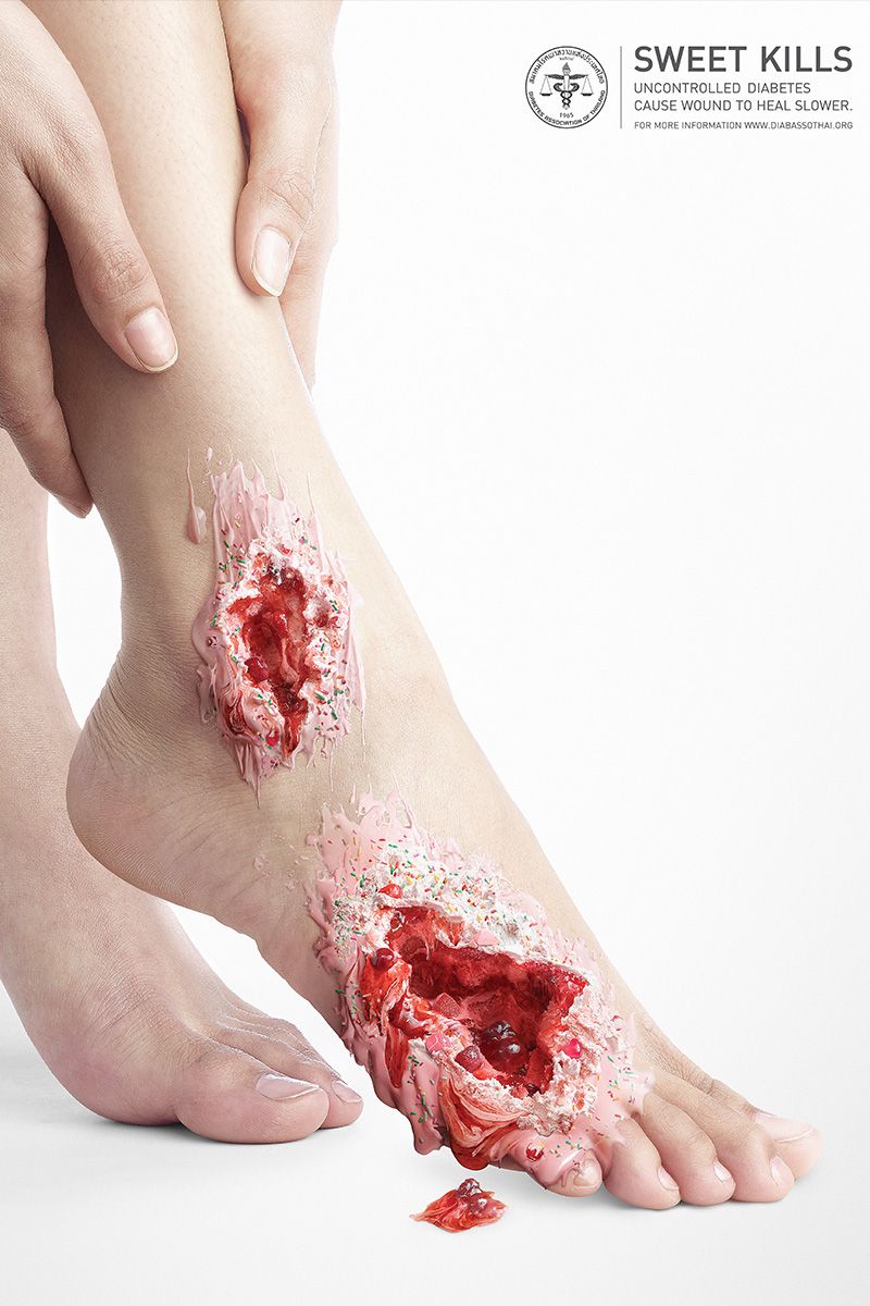 Sweet Kills: publicidad contra la diabetes 5