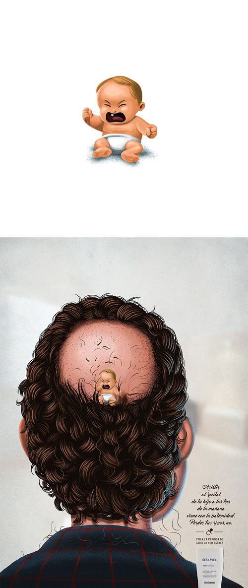 Seskavel - Pérdida de cabello 5