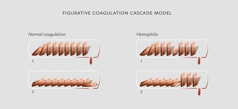 Basic Guide of Hemophilia 3