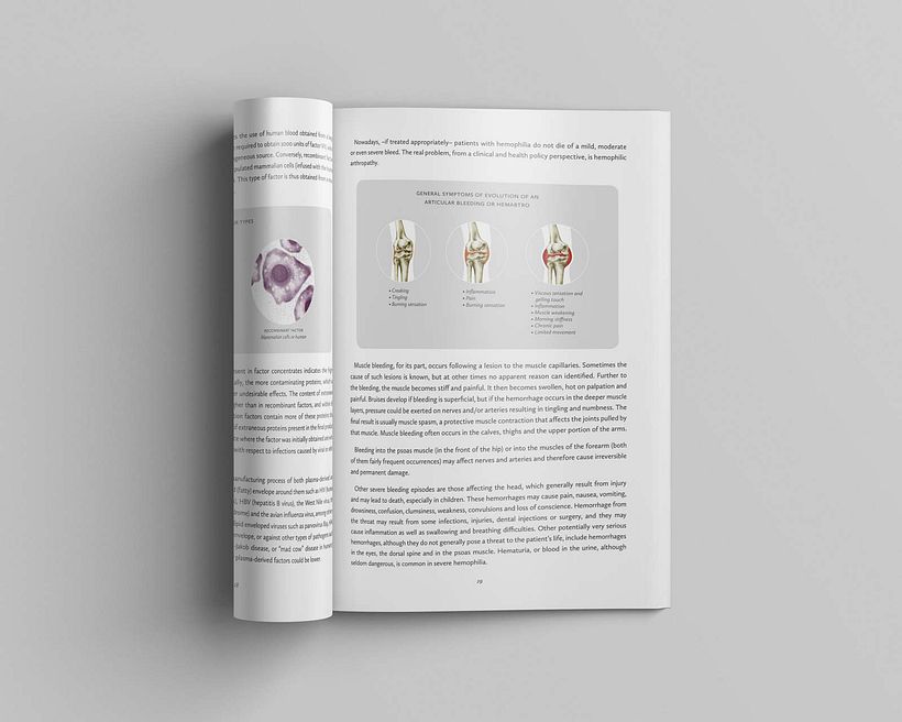 Basic Guide of Hemophilia 16