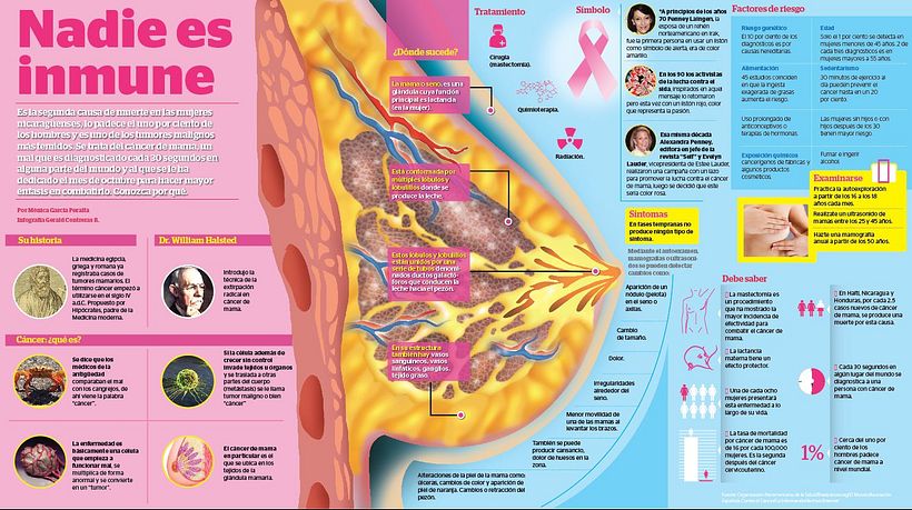 Infografía: Cáncer de mama. 0