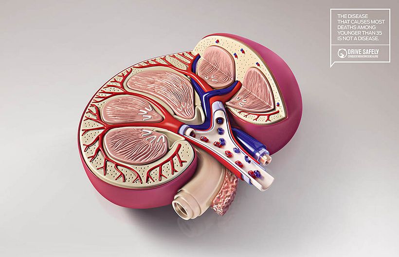 Drive Safely Awareness 1