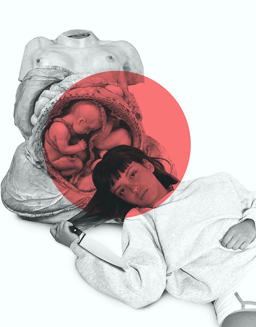 Aborto -1