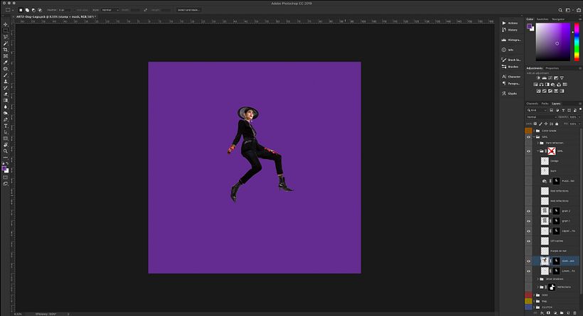 Relleno de muslo izquierdo luego de recorte.