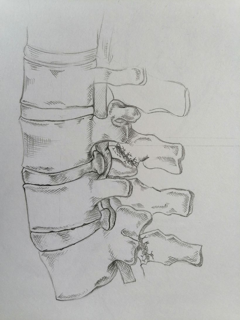 Exploración Osea de la Columna Lumbar  3