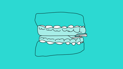 Stop Ronquidos - Palomo Luque Odontólogos 22