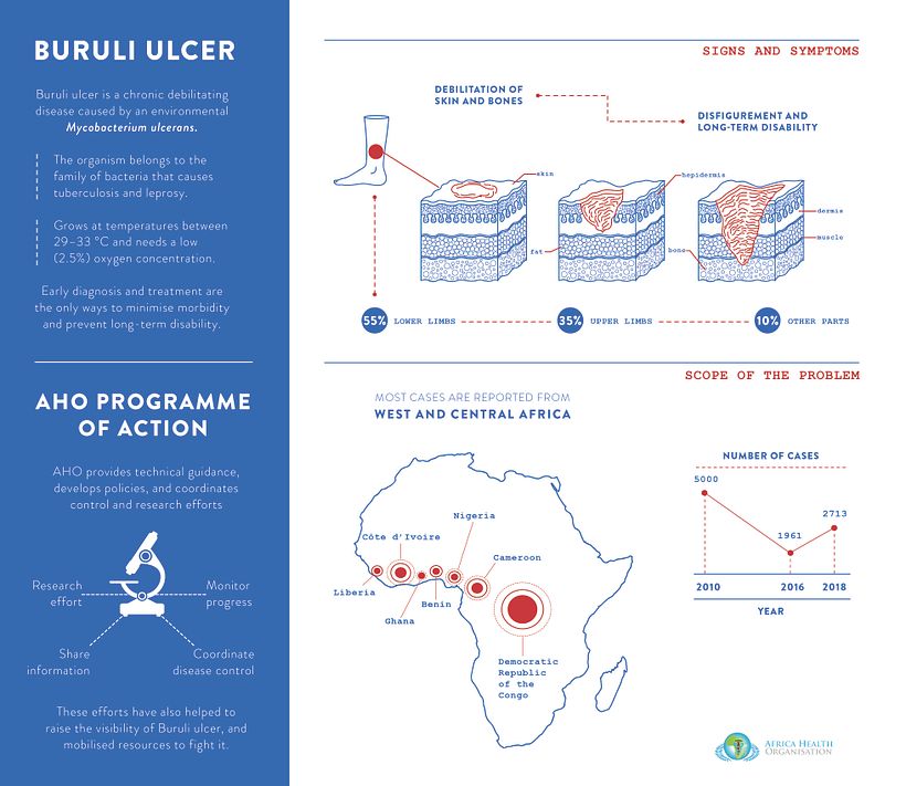 Infographic 4