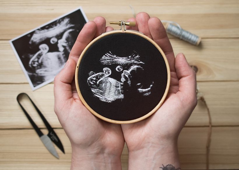 Ultrasound Embroidery  - Artesanía