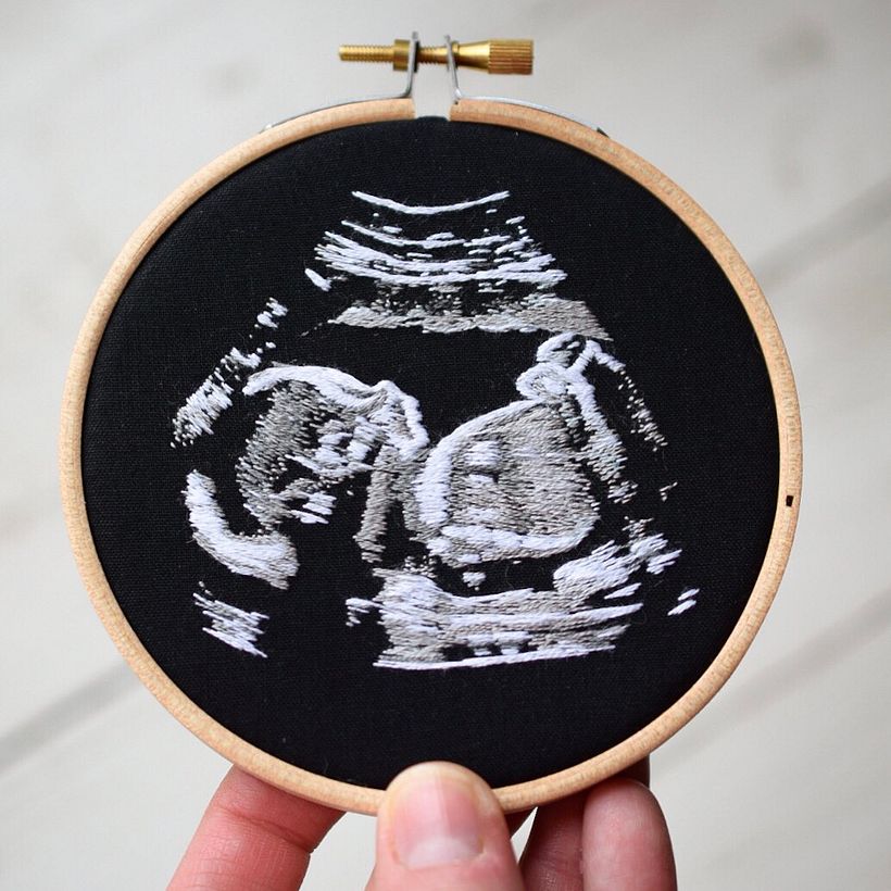 Ultrasound Embroidery  - Artesanía