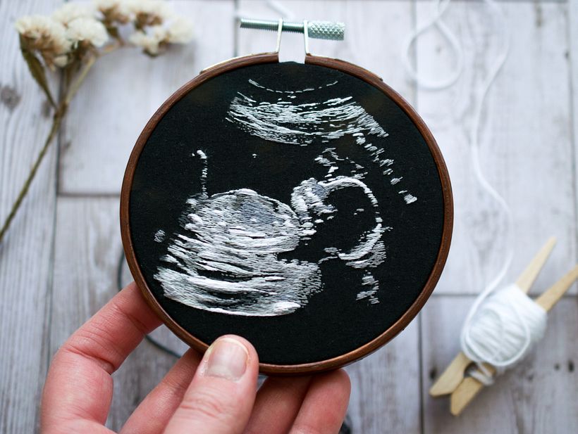 Ultrasound Embroidery  - Artesanía