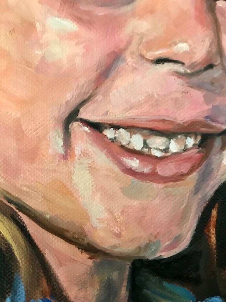 Detalle