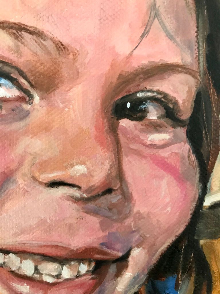 Detalle