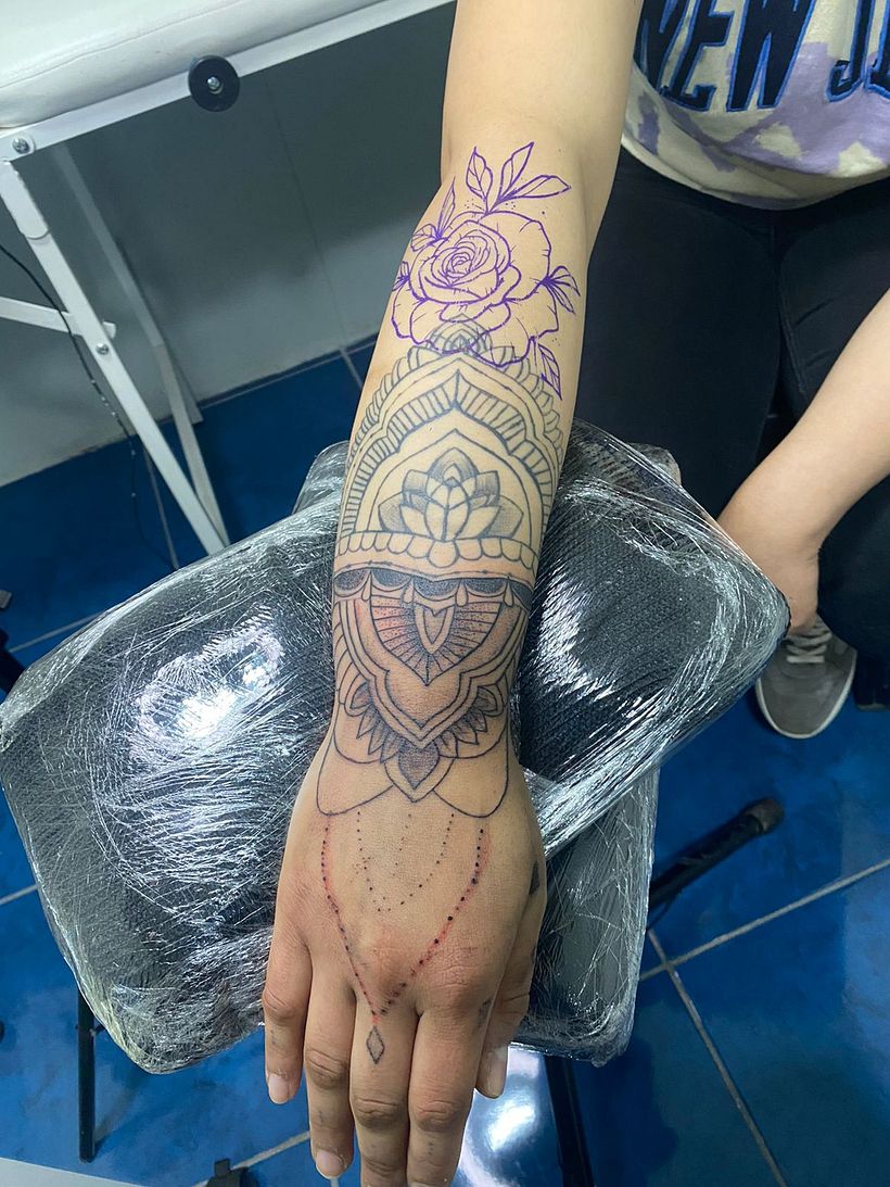 otra imagen del procedimiento 