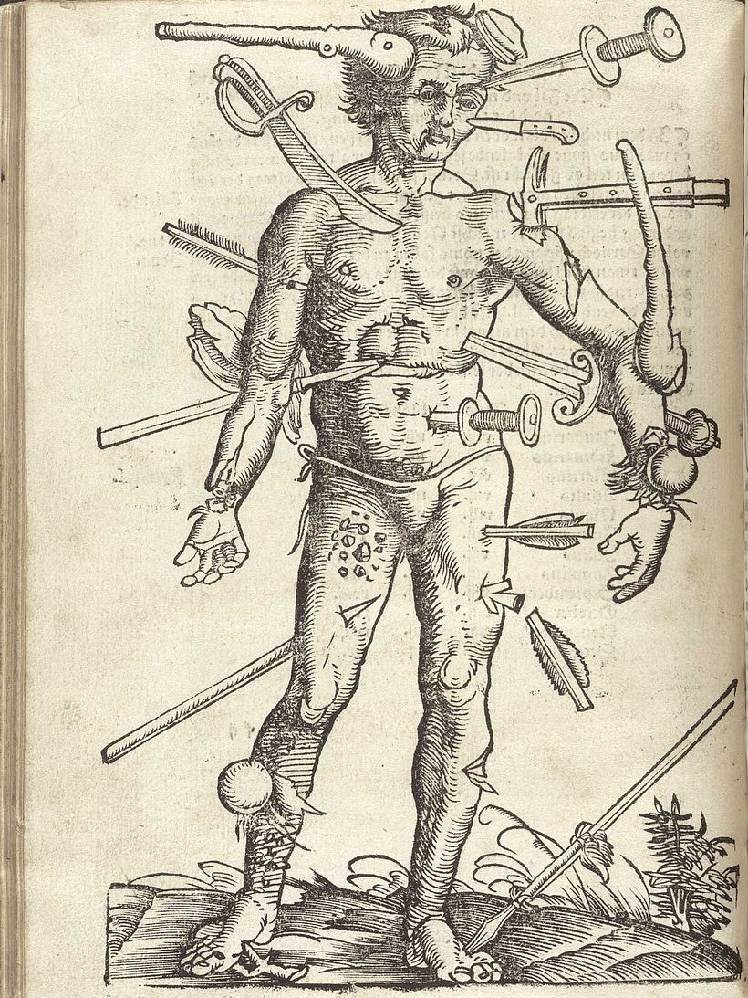 Wound Man.
