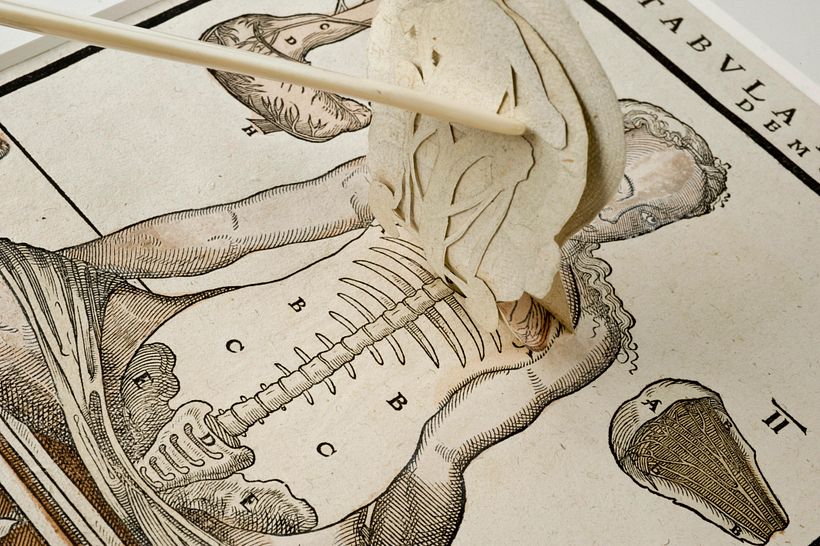 Flap anatomies.